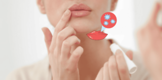 5 Causes Of Chapped Lips, And How Treatment Improves