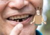 Periodontal Disease And Missing Teeth Increase The Risk Of Dementia