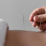 Close Up Hand Holding Acupuncture Needle (1)