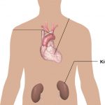 世界多囊腎關注日 高風險族群 4種診斷確認是否罹患多囊腎 ？